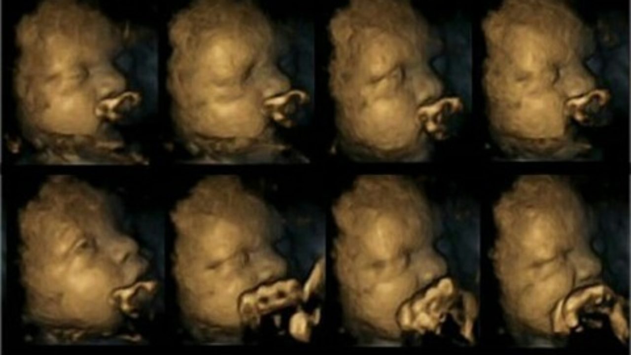 タバコが胎児に与える影響がわかるエコー写真 ふたばのブログ 理科教育と道徳教育を科学する