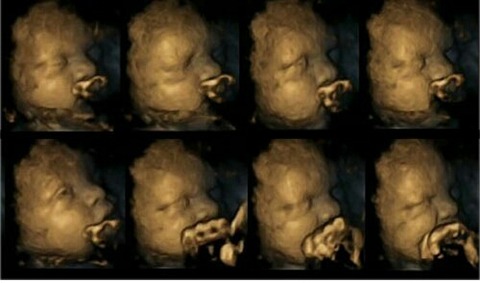 タバコが胎児に与える影響がわかるエコー写真